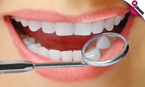 Zoom Teeth Whitening + Consultation!